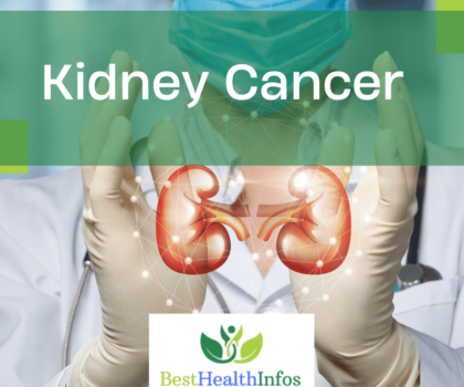 Kidney Cancer