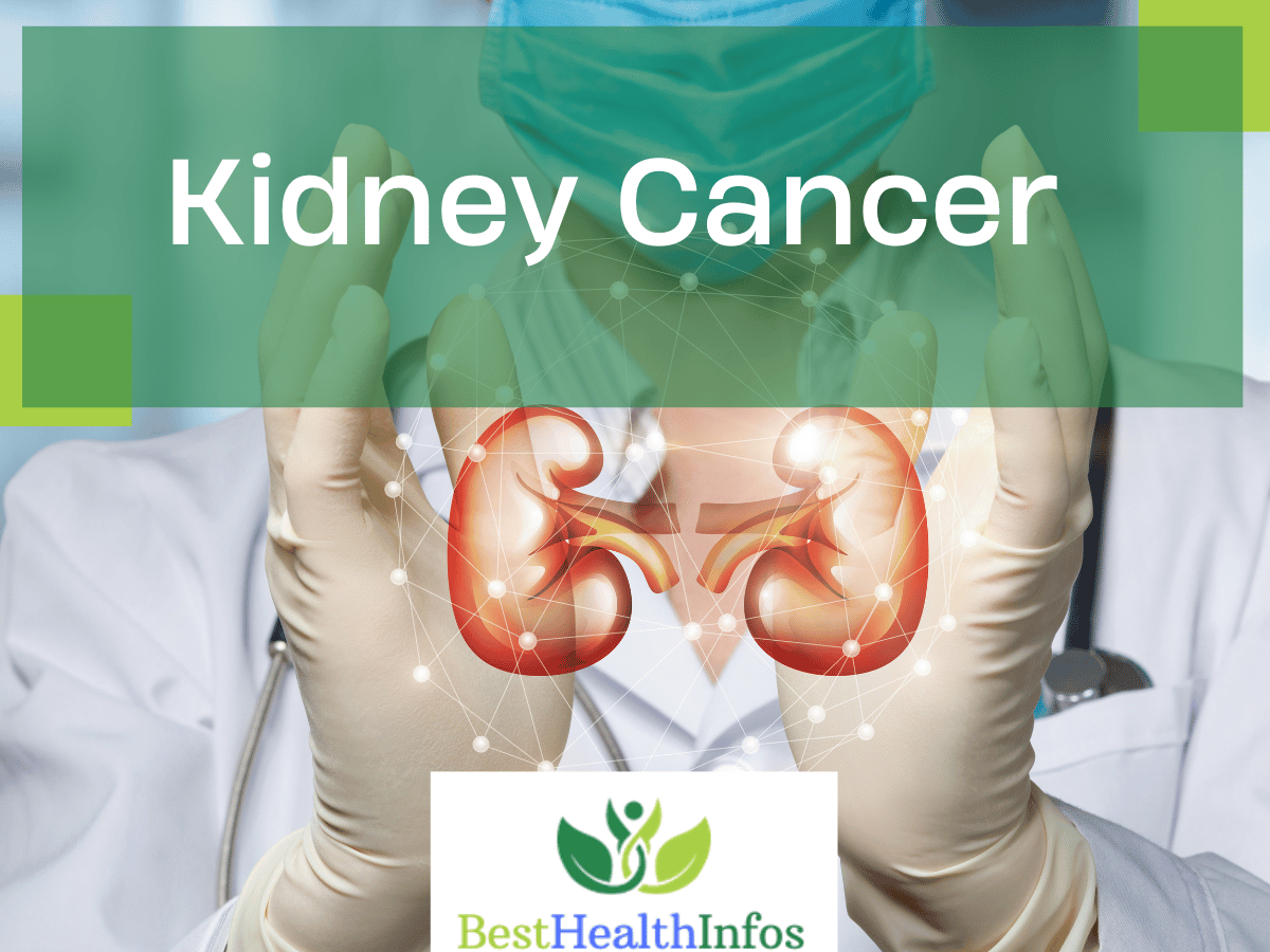 Kidney Cancer