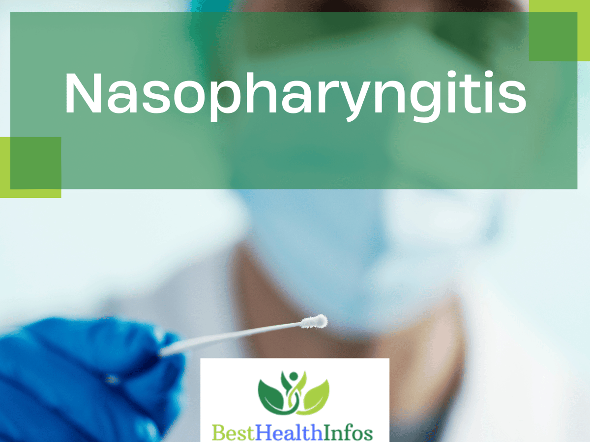 Nasopharygitis