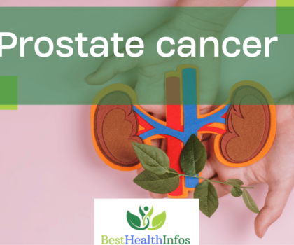 Prostate cancer