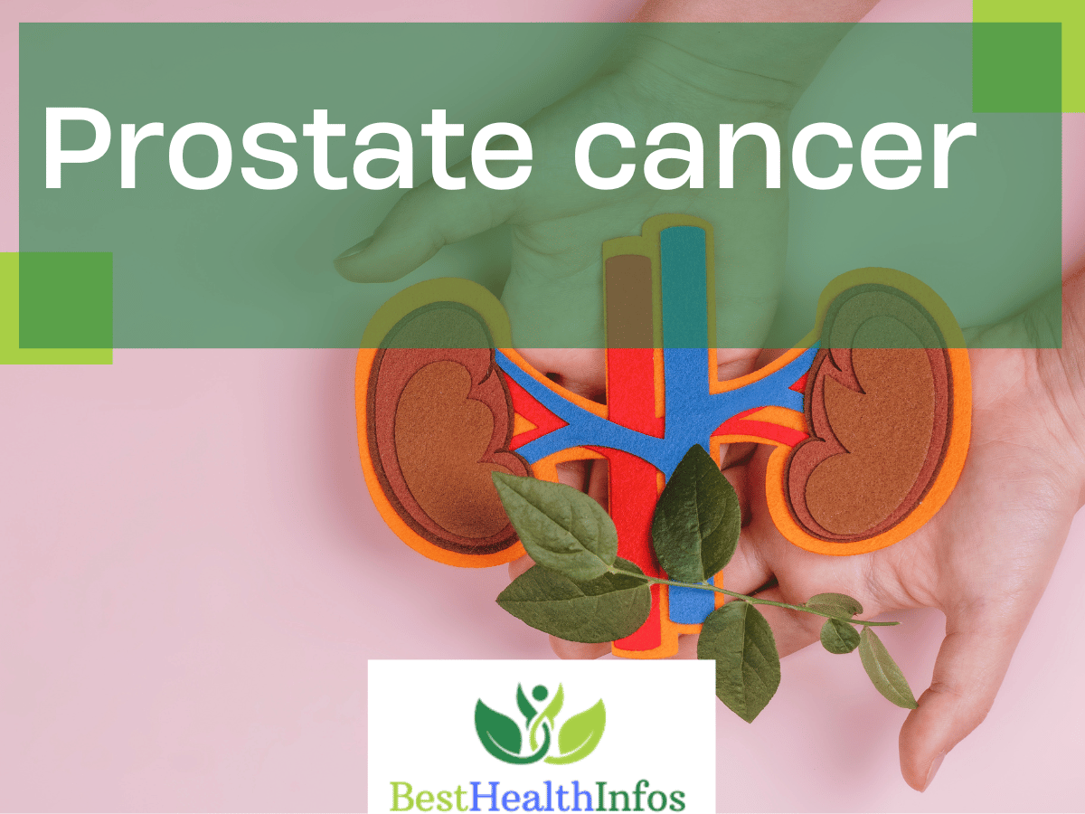 Prostate cancer